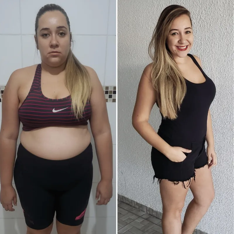 Antes e depois de cliente usando Violine Shape