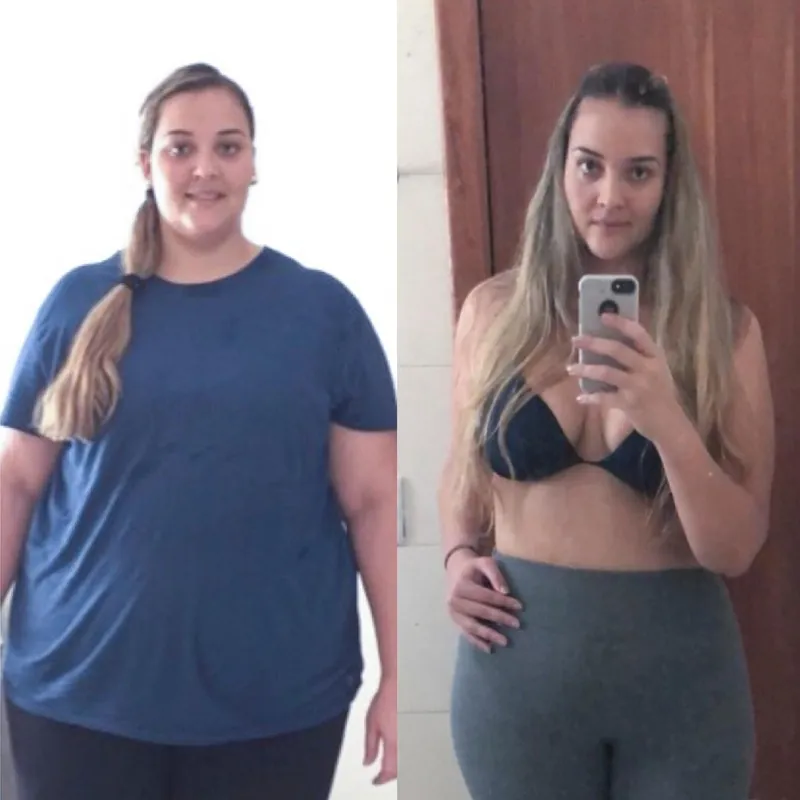 Antes e depois de cliente usando Violine Shape